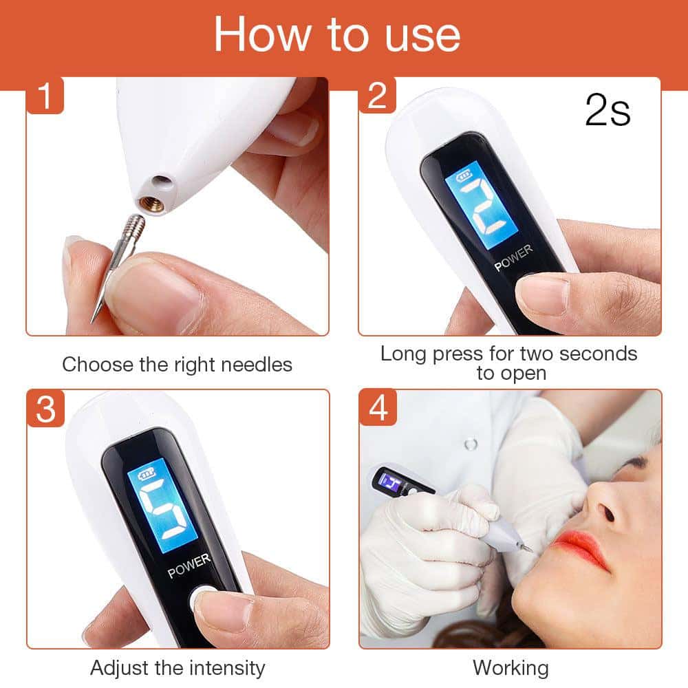 Laser Plasma Pen Skin Tag Remover – 9‑Level Precision