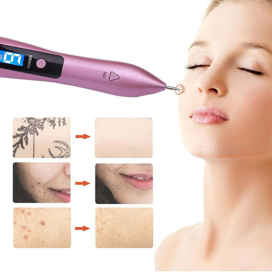 Laser Plasma Pen Skin Tag Remover – 9‑Level Precision